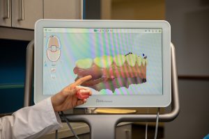A dentist shows you the 3d scan of your teeth.